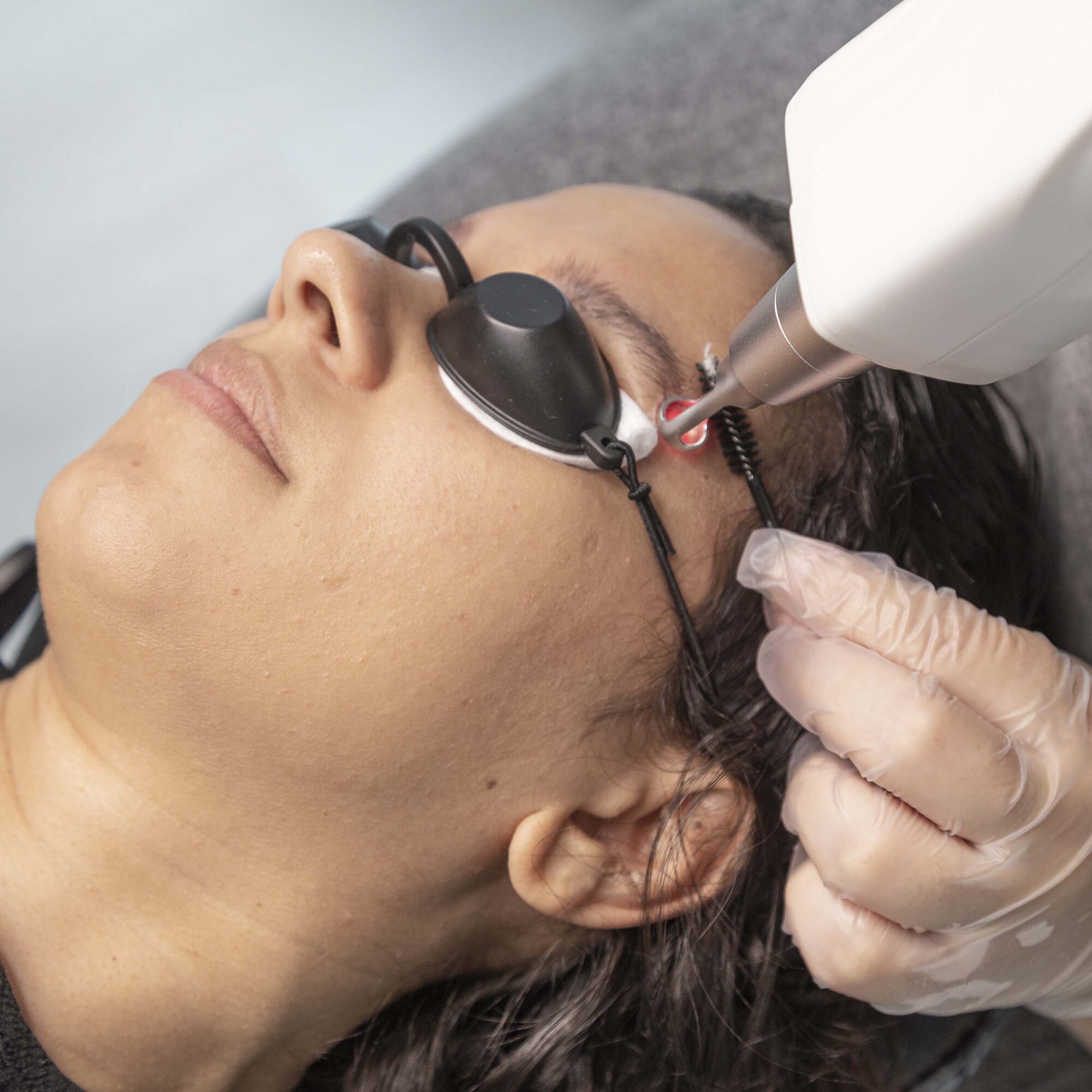 Borrado de Micropigmentación / Microblading
